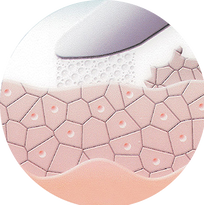 Die Mikrodermabrasion trägt sanft und sicher die Hornzellen ab. Zum Vorschein kommt eine zarte, glatte Oberfläche.